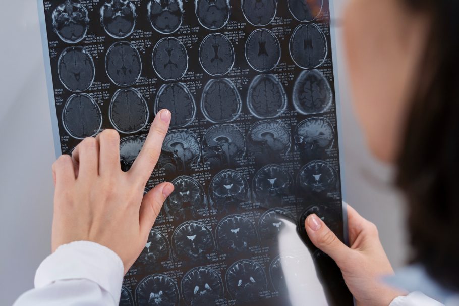 Symbolbild Neurologie